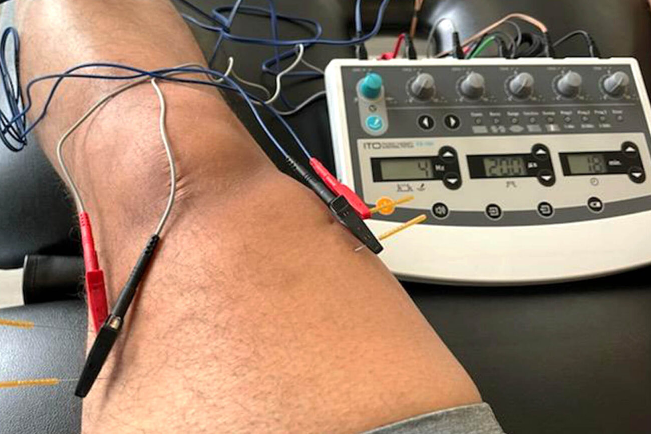 Fox Physical Therapy Dry Needling DN Miami