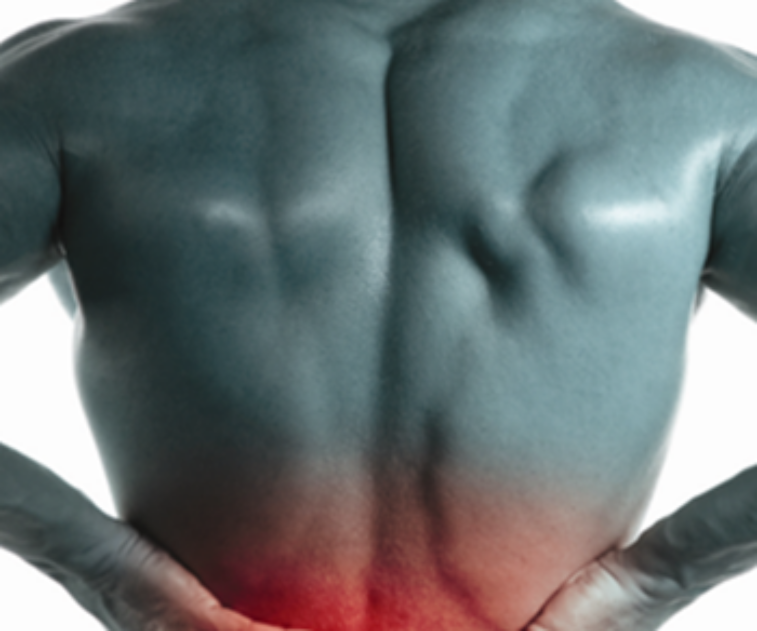 McKenzie-Method-of-Mechanical-Diagnosis-and-Therapy