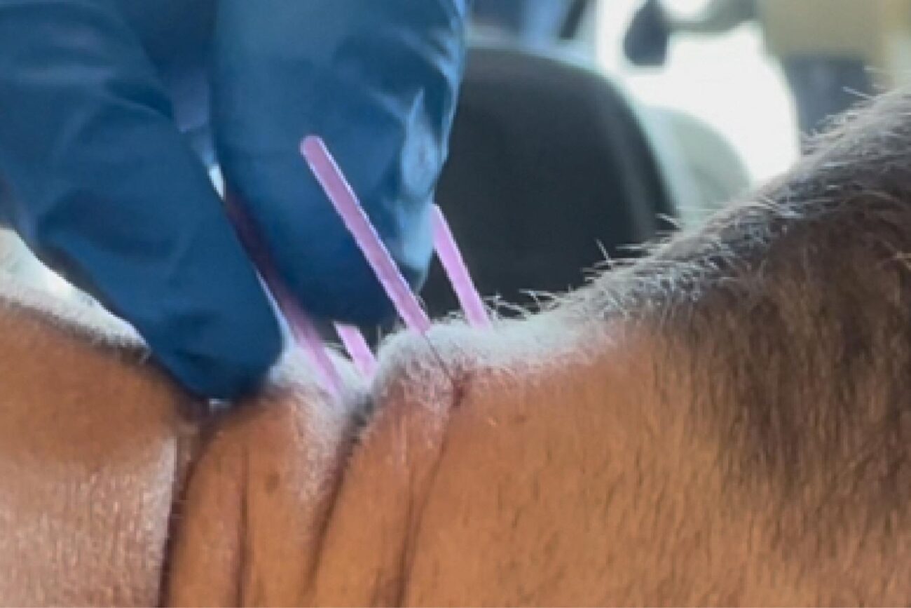 dry needle physical therapy miami